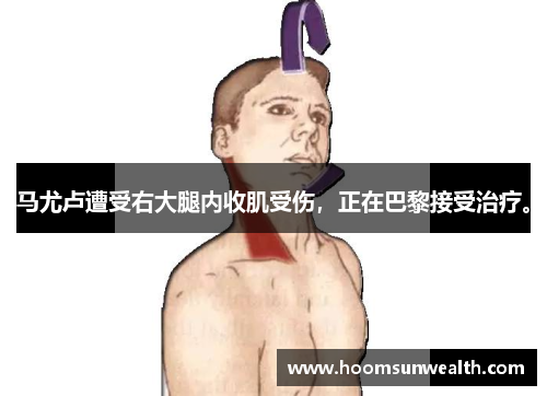 马尤卢遭受右大腿内收肌受伤，正在巴黎接受治疗。